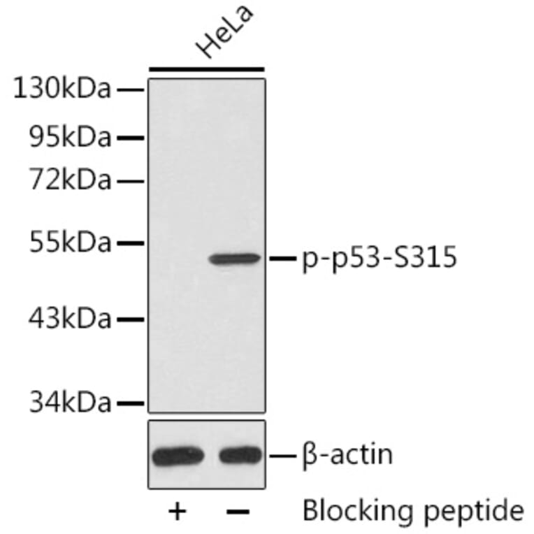 Western Blot - Anti-p53 (phospho Ser315) Antibody (A10954) - Antibodies.com