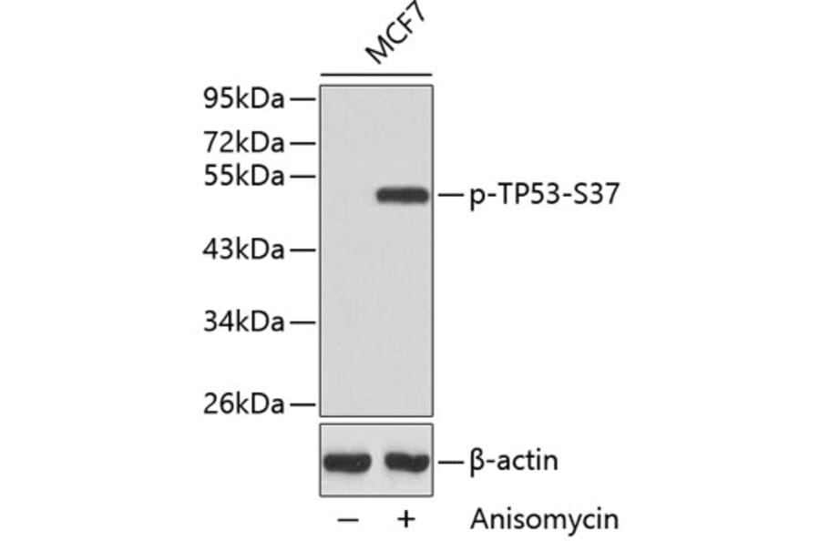 Western Blot - Anti-TP53 (phospho S37) Antibody (AP0463) - Antibodies.com