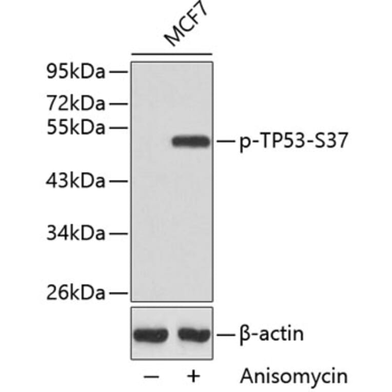 Western Blot - Anti-TP53 (phospho S37) Antibody (AP0463) - Antibodies.com