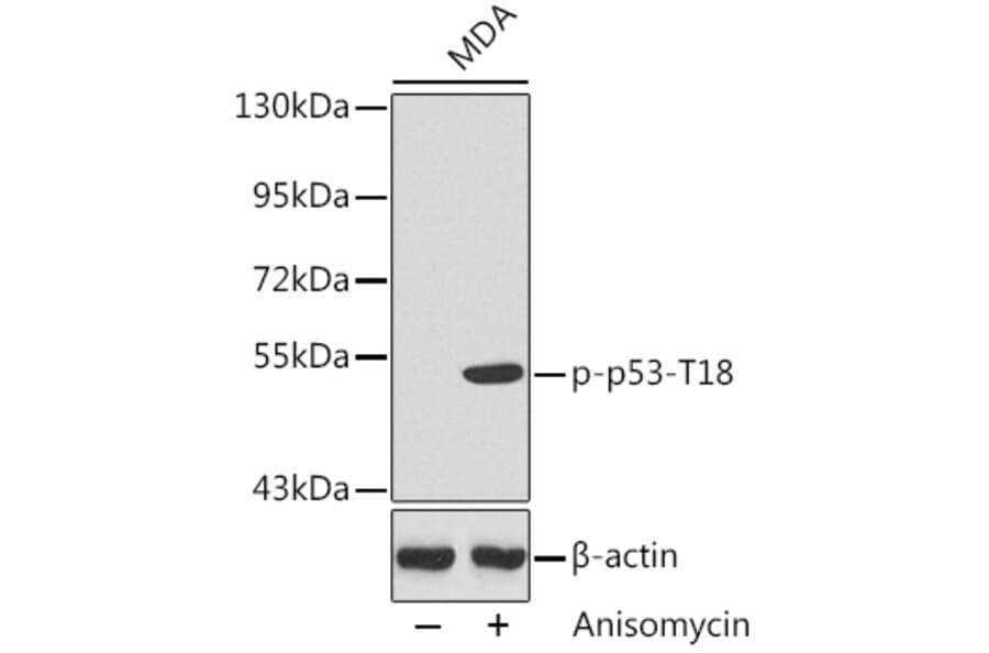 Western Blot - Anti-p53 (phospho Thr18) Antibody (A10956) - Antibodies.com