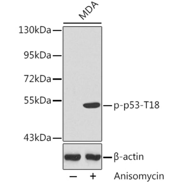 Western Blot - Anti-p53 (phospho Thr18) Antibody (A10956) - Antibodies.com