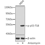 Western Blot - Anti-p53 (phospho Thr18) Antibody (A10956) - Antibodies.com