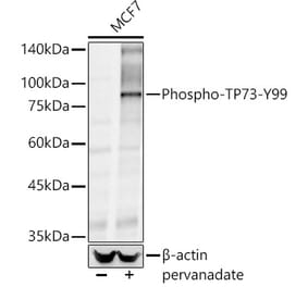 Western Blot - Anti-p73 (phospho Tyr99) Antibody (A10957) - Antibodies.com