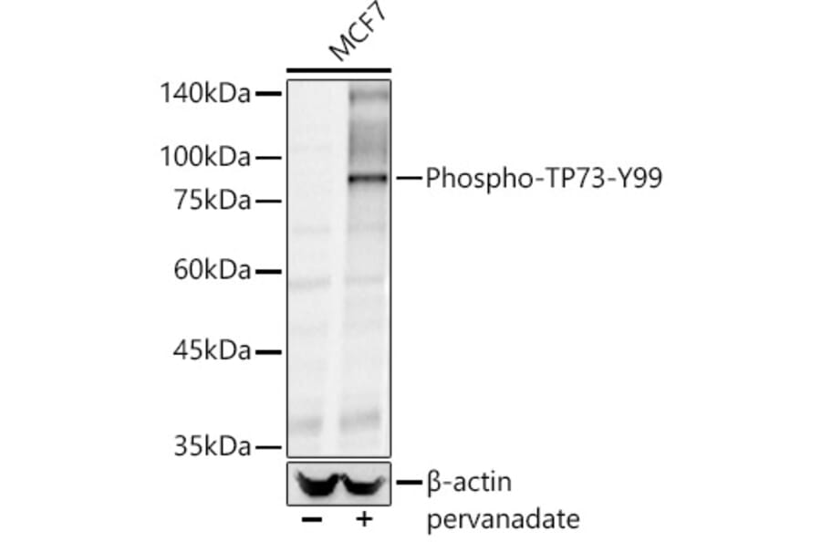 Western Blot - Anti-p73 (phospho Tyr99) Antibody (A10957) - Antibodies.com