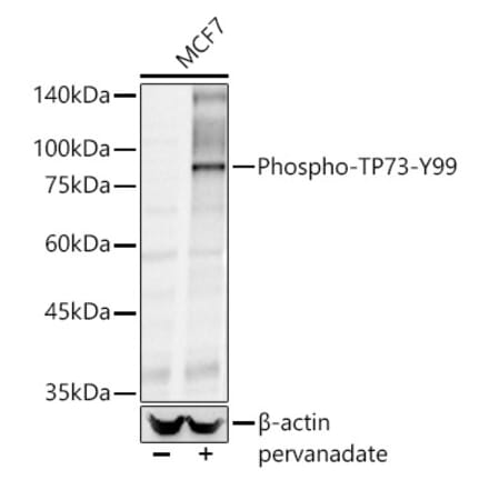 Western Blot - Anti-p73 (phospho Tyr99) Antibody (A10957) - Antibodies.com