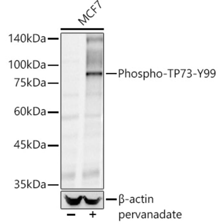 Western Blot - Anti-p73 (phospho Tyr99) Antibody (A10957) - Antibodies.com