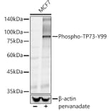 Western Blot - Anti-p73 (phospho Tyr99) Antibody (A10957) - Antibodies.com