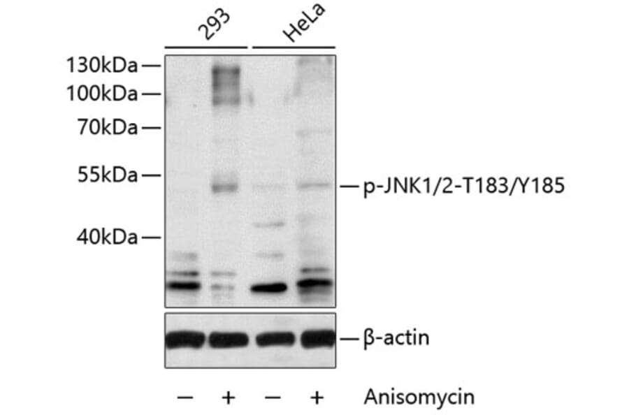 Western Blot - Anti-JNK1 + JNK2 (phospho Thr183 + Tyr185) Antibody (A10960) - Antibodies.com