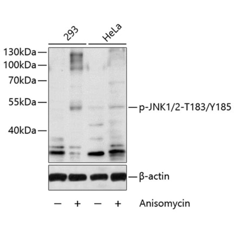 Western Blot - Anti-JNK1 + JNK2 (phospho Thr183 + Tyr185) Antibody (A10960) - Antibodies.com