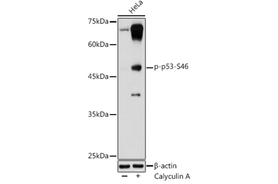 Western Blot - Anti-p53 (phospho Ser46) Antibody (A10961) - Antibodies.com