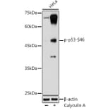 Western Blot - Anti-p53 (phospho Ser46) Antibody (A10961) - Antibodies.com