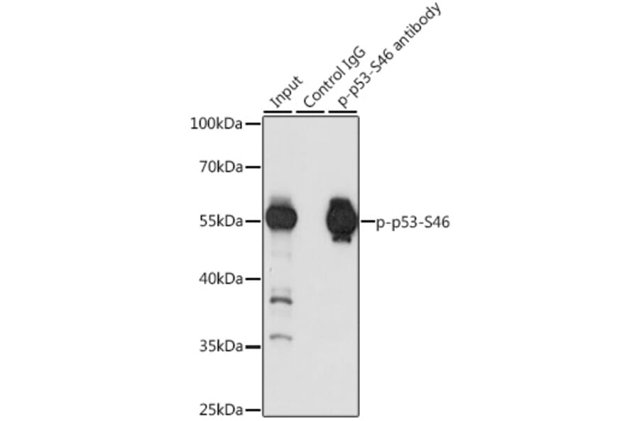 Western Blot - Anti-p53 (phospho Ser46) Antibody (A10961) - Antibodies.com