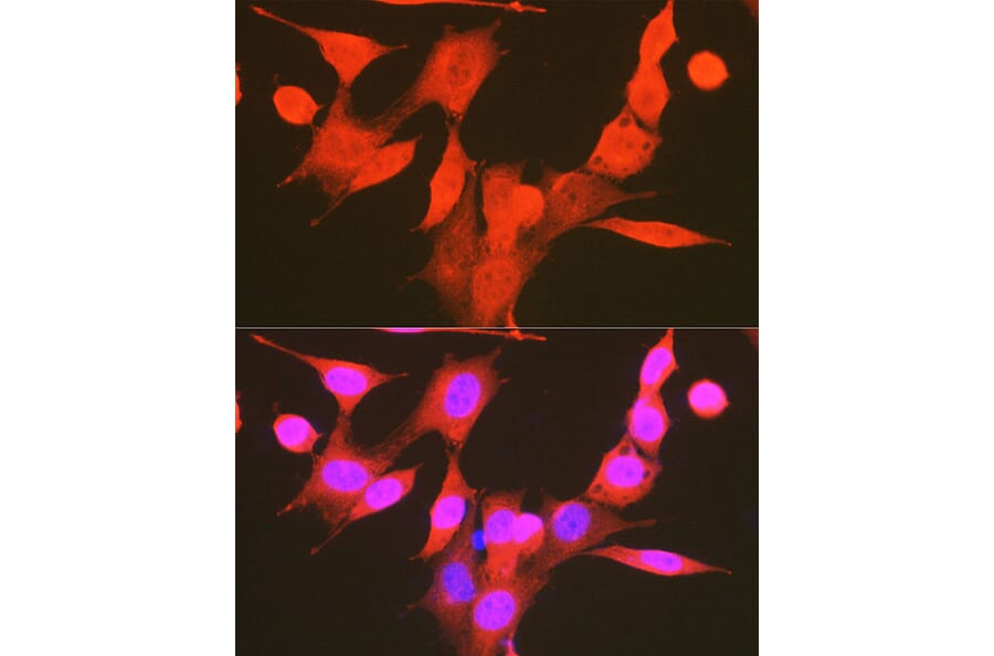 Immunofluorescence - Anti-PDPK1 (phospho Ser241) Antibody (A10962) - Antibodies.com