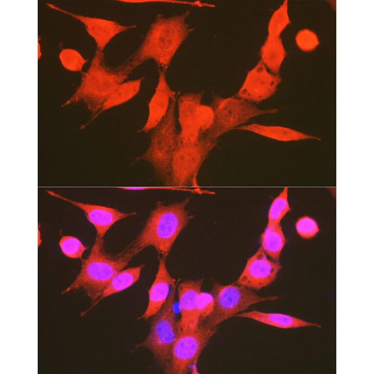 Immunofluorescence - Anti-PDPK1 (phospho Ser241) Antibody (A10962) - Antibodies.com