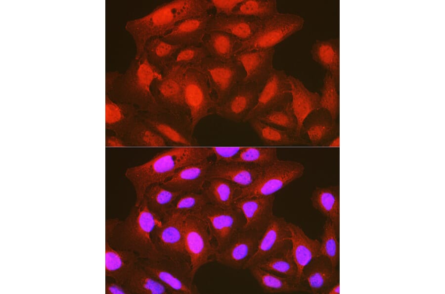Immunofluorescence - Anti-PDPK1 (phospho Ser241) Antibody (A10962) - Antibodies.com
