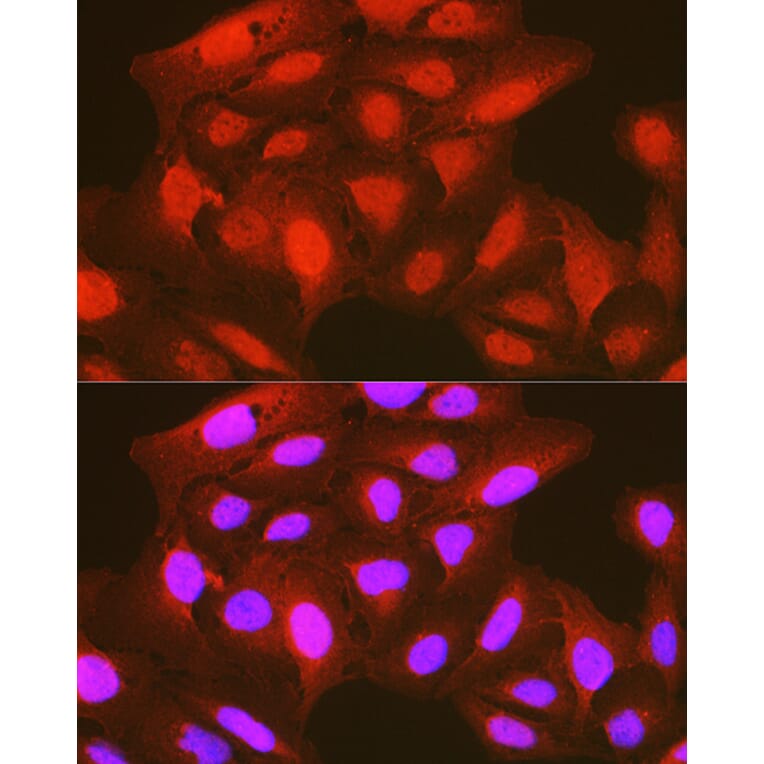 Immunofluorescence - Anti-PDPK1 (phospho Ser241) Antibody (A10962) - Antibodies.com