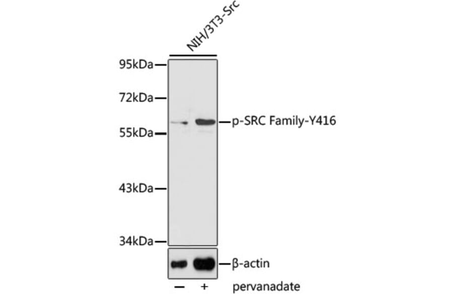 Western Blot - Anti-SRC Family (phospho Tyr416) Antibody (A10965) - Antibodies.com