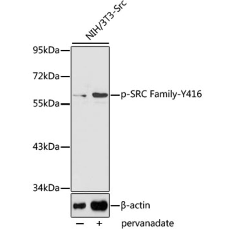 Western Blot - Anti-SRC Family (phospho Tyr416) Antibody (A10965) - Antibodies.com
