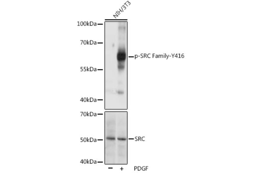 Western Blot - Anti-SRC Family (phospho Tyr416) Antibody (A10965) - Antibodies.com