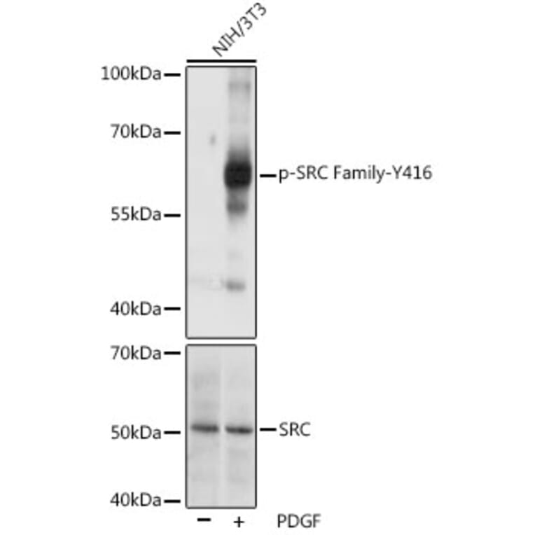 Western Blot - Anti-SRC Family (phospho Tyr416) Antibody (A10965) - Antibodies.com