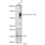 Western Blot - Anti-SRC Family (phospho Tyr416) Antibody (A10965) - Antibodies.com