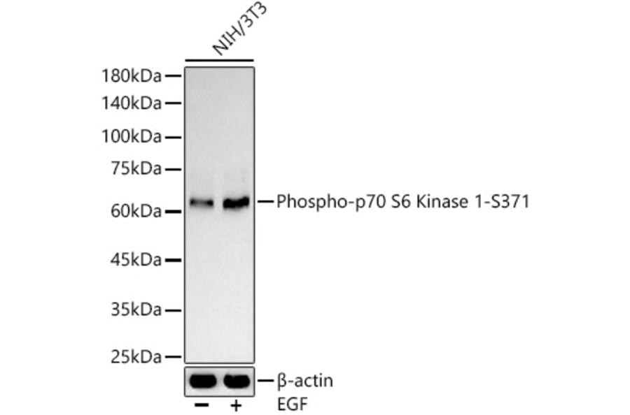 Western Blot - Anti-S6K1 (phospho Ser371) Antibody (A10967) - Antibodies.com