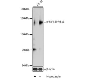 Western Blot - Anti-Rb (phospho Ser807 + Ser811) Antibody (A10969) - Antibodies.com