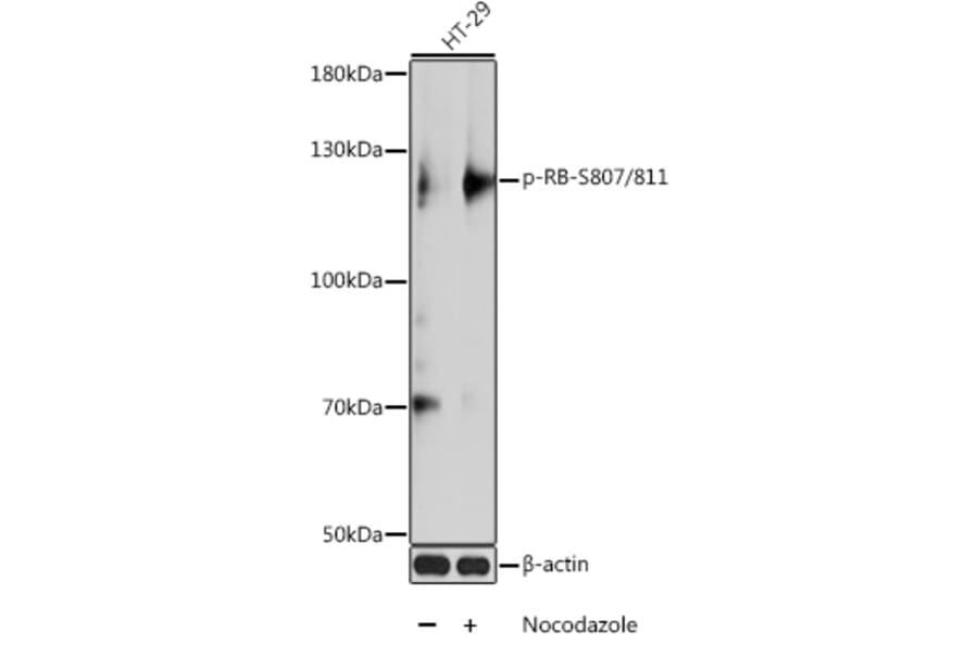 Western Blot - Anti-Rb (phospho Ser807 + Ser811) Antibody (A10969) - Antibodies.com