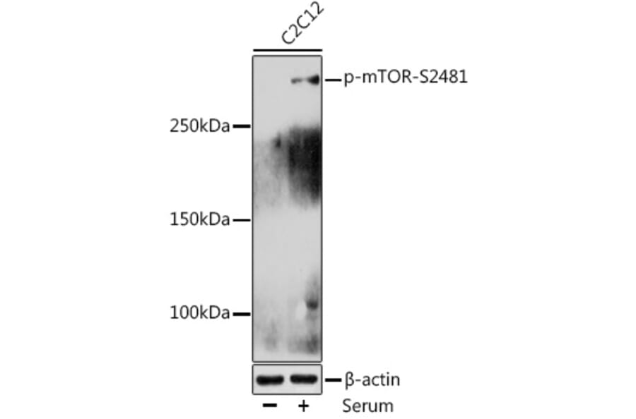Western Blot - Anti-mTOR (phospho Ser2481) Antibody (A10970) - Antibodies.com