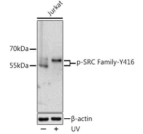 Western Blot - Anti-SRC family (phospho Tyr416) Antibody (A10971) - Antibodies.com
