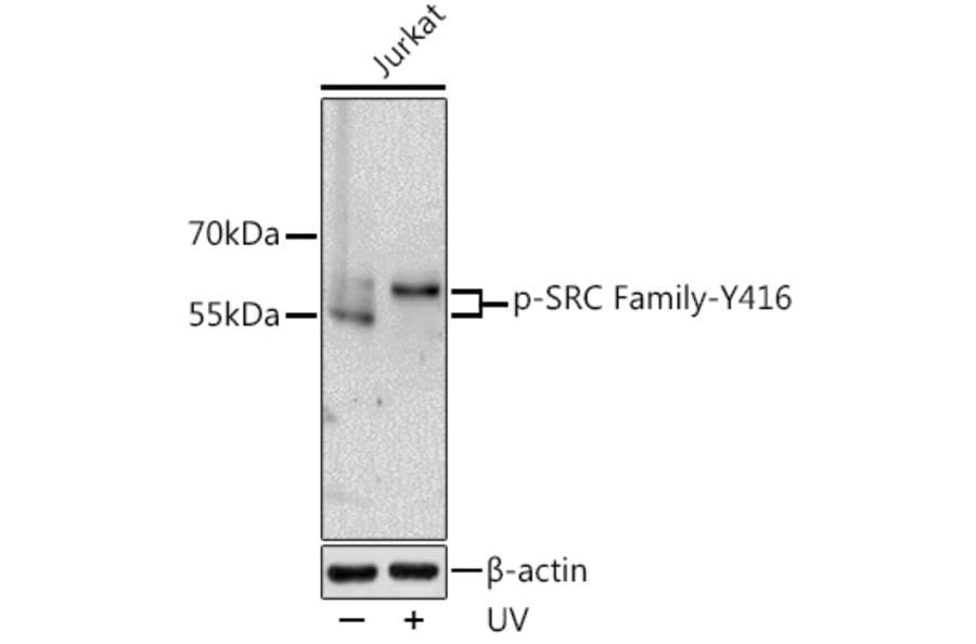 Western Blot - Anti-SRC family (phospho Tyr416) Antibody (A10971) - Antibodies.com