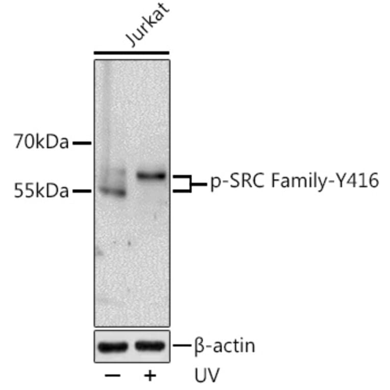 Western Blot - Anti-SRC family (phospho Tyr416) Antibody (A10971) - Antibodies.com
