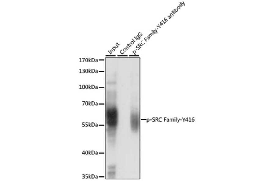 Western Blot - Anti-SRC family (phospho Tyr416) Antibody (A10971) - Antibodies.com