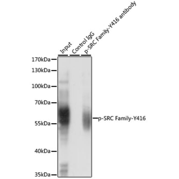 Western Blot - Anti-SRC family (phospho Tyr416) Antibody (A10971) - Antibodies.com