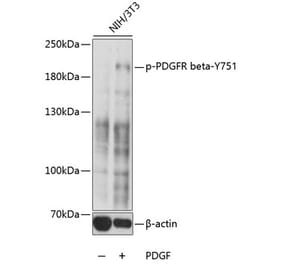 Western Blot - Anti-PDGFR beta (phospho Tyr751) Antibody (A10973) - Antibodies.com