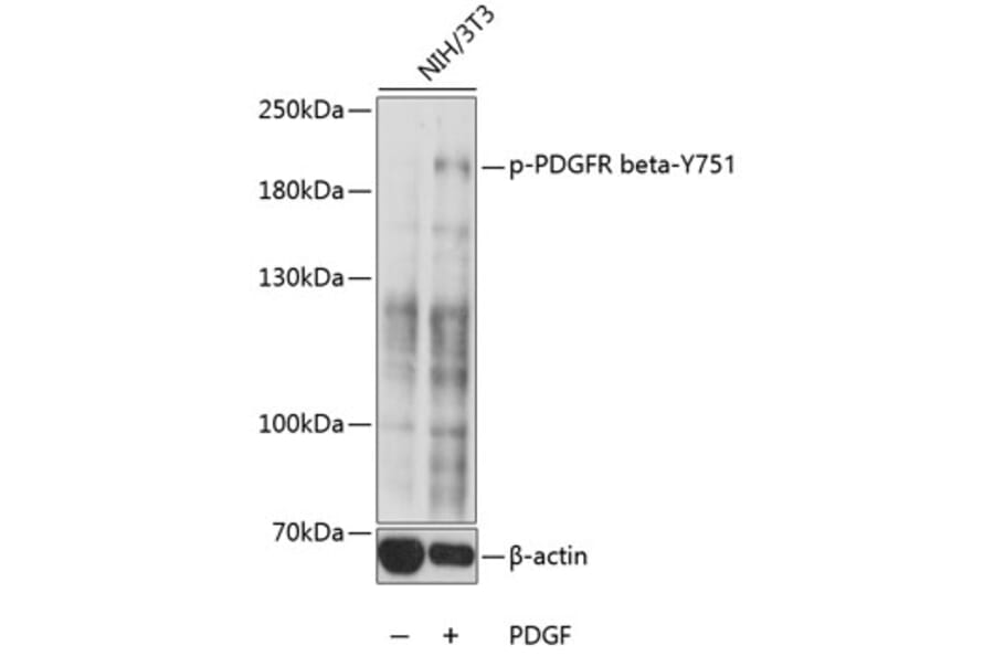 Western Blot - Anti-PDGFR beta (phospho Tyr751) Antibody (A10973) - Antibodies.com