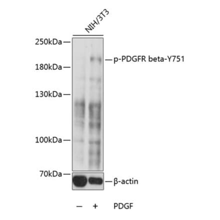 Western Blot - Anti-PDGFR beta (phospho Tyr751) Antibody (A10973) - Antibodies.com