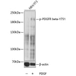 Western Blot - Anti-PDGFR beta (phospho Tyr751) Antibody (A10973) - Antibodies.com