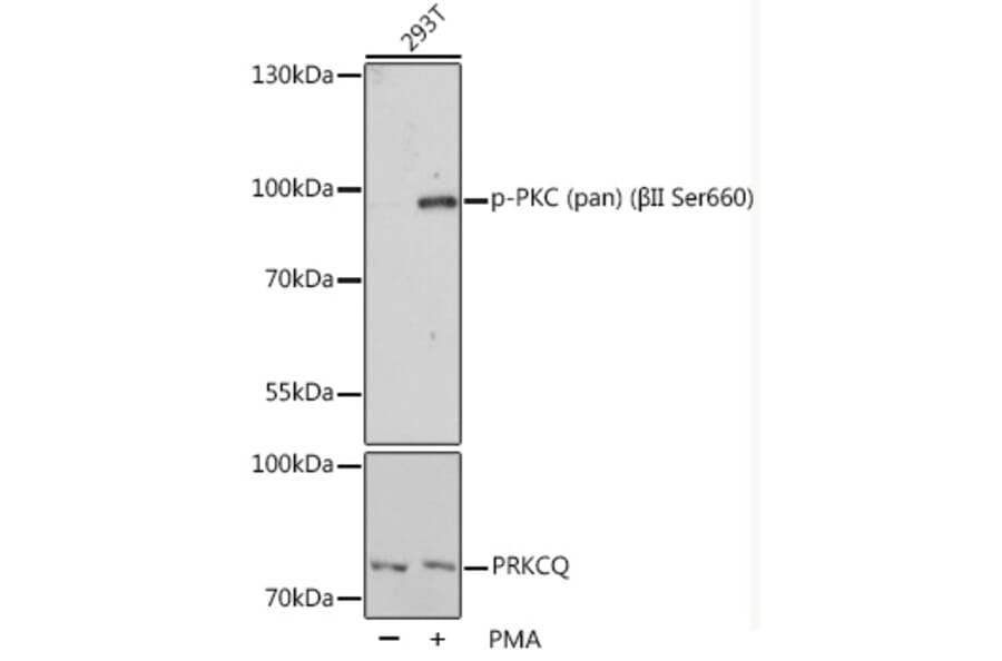 Western Blot - Anti-pan PKC (phospho Ser660) Antibody (A10975) - Antibodies.com