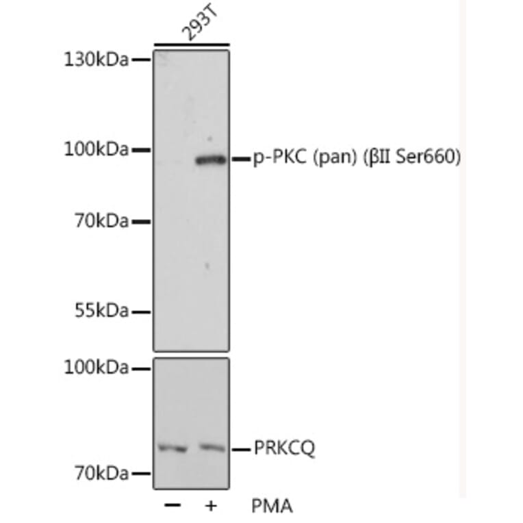 Western Blot - Anti-pan PKC (phospho Ser660) Antibody (A10975) - Antibodies.com
