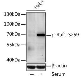 Western Blot - Anti-Raf1 (phospho Ser259) Antibody (A10977) - Antibodies.com