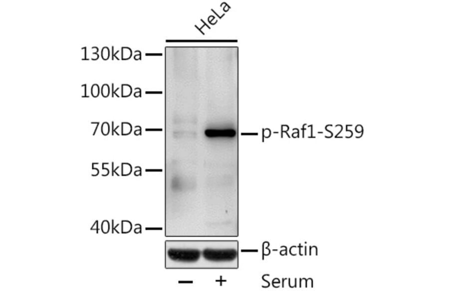 Western Blot - Anti-Raf1 (phospho Ser259) Antibody (A10977) - Antibodies.com