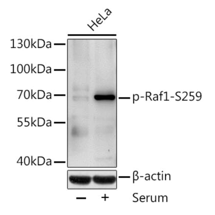Western Blot - Anti-Raf1 (phospho Ser259) Antibody (A10977) - Antibodies.com