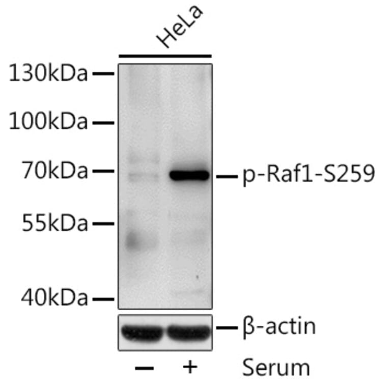 Western Blot - Anti-Raf1 (phospho Ser259) Antibody (A10977) - Antibodies.com