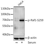 Western Blot - Anti-Raf1 (phospho Ser259) Antibody (A10977) - Antibodies.com