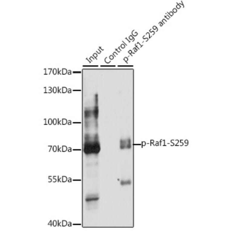 Western Blot - Anti-Raf1 (phospho Ser259) Antibody (A10977) - Antibodies.com