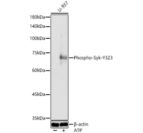 Western Blot - Anti-Syk (Phospho Y323) Antibody (A10980) - Antibodies.com