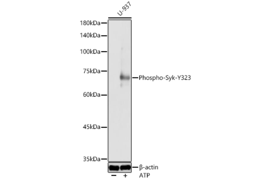 Western Blot - Anti-Syk (Phospho Y323) Antibody (A10980) - Antibodies.com