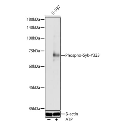Western Blot - Anti-Syk (Phospho Y323) Antibody (A10980) - Antibodies.com