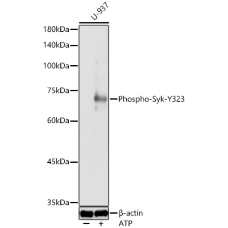 Western Blot - Anti-Syk (Phospho Y323) Antibody (A10980) - Antibodies.com